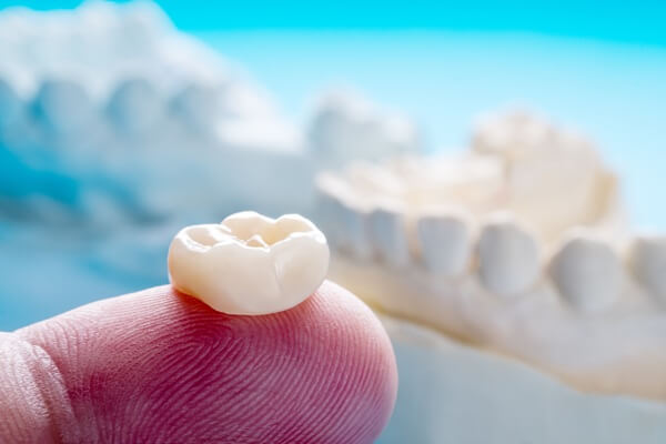 dental-crowns-paramount-dentistry-at-stonechurch