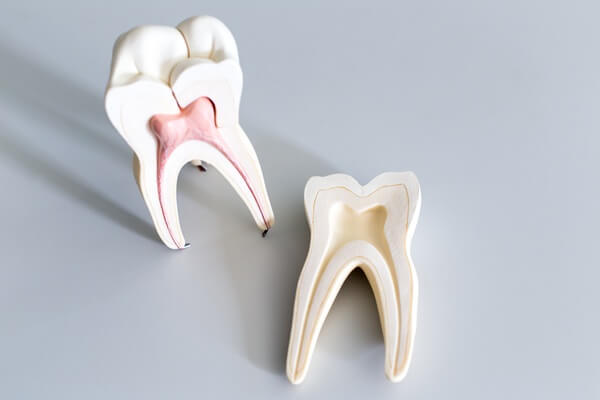 root-canal-therapy-paramount-dentistry-at-stonechurch