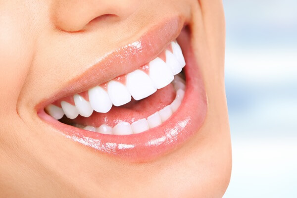 teeth-whitening-paramount-dentistry-at-stonechurch